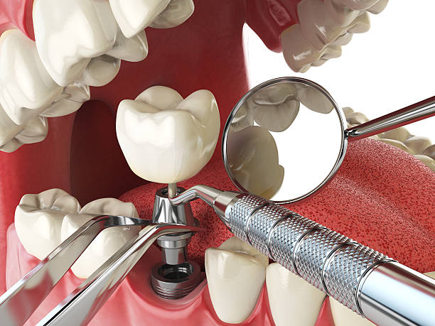 Best Emergency Dental Services for Seniors in Gold River, CA